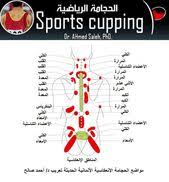 Sports Cupping الحجامة الرياضية مواضع الحجامة الالماني حديثة German Hijama Point Hijama Cupping Therapy Health