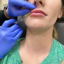 Renaitre medical aesthetics began as a shared vision of 3 local healthcare providers. Renaitre A Williamson Cosmetic Center Home Facebook