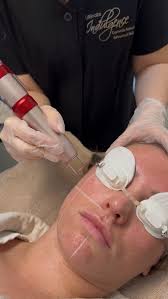 Get ready to tune in for an electrifying live stream with our founder Nancy  Abdou! ⚡️ We'll be discussing all things Radiofrequency