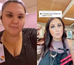 #duet with @rachel.mackenzlee im just going to leave this here 👁  #oneeyegang #oneeye #childhoodinjury #childhoodtruama #weareyeprotection  #fakeeye #prostheticeye #lawnmoweraccident ##enucleation