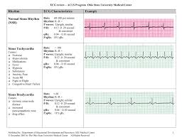 Ekg Flash Chart