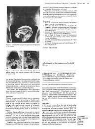 Albendazole in the Treatment of Hydatid Disease