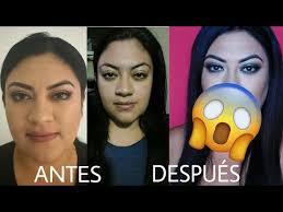 Cuando mucho lo que puede. Mi Resultado Despues De La Bichectomia Antes Y Despues Youtube