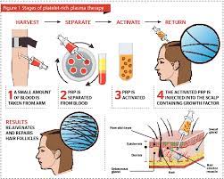 University of nottingham, malaysia > study > how to apply. Aesthetic Courses In Prp