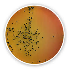 The two species of salmonella are salmonella enterica and salmonella bongori. Salmonella Shigella Agar Media For Salmonella Shigella Anhydrous Nutrient Media For Microbiology Microbiology Life Science Carl Roth International