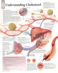Understanding Cholesterol Educational Chart Poster