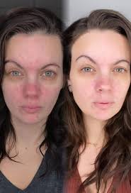 I seriously love our Age Reversist skincare line. COMMENT if you need help  with wrinkles, fine lines, crows feet, smile lines, and more! 🖤