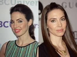 Facelifts, botox treatment and filler are three common methods that . Celebreeties Celebreeties Twitter