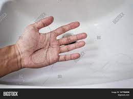 In medical terms, hair loss is also known as alopecia, which can affect any part of the scalp or body part. Close Man Hand Loss Image Photo Free Trial Bigstock