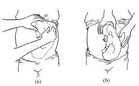 Dec 05, 2020 · yes, you can hear the baby's heartbeats with a stethoscope. Antenatal Care Module 11 Assessing The Fetus View As Single Page