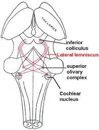Neurological lesion identification motor (corticospinal pathway) localises the lesion to the contralateral medial brainstem. Alireza Alirezamlk1999 Profile Pinterest