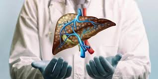 Understanding Grade 1 Fatty Liver ...