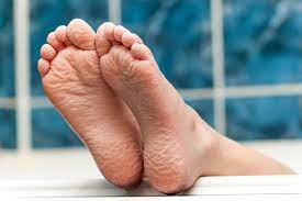 The covering, which cannot contract any further, is then obliged to wrinkle and buckle, in order to preserve surface area while containing the lesser volume. Why Do Our Fingers And Toes Wrinkle During A Bath Scientific American