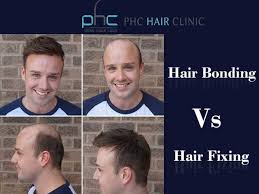 It is one of the traditional methods of hair fixing. Hair Bonding Vs Hair Fixing What You Need To Consider About It Phc