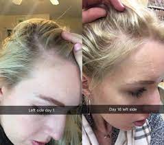 How to revive dead hair follicles. 25 Products That Ll Help Bring Dead Hair Back To Life