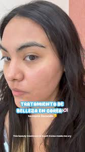 TRATAMIENTO DE BELLEZA EN COREA DEL SUR🩵🇰🇷 ME HICIERON LLORAR?😭  #seoulbeauty #seoulbeautyglobal #kbeauty #beautyservicesinkorea #korea  #KPop #paupauri