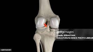 34 Acl High Res Illustrations - Getty Images