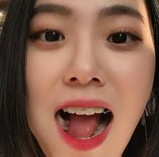 K O R E A N Braces Girls Korean Girl Fashion Cute Korean Girl