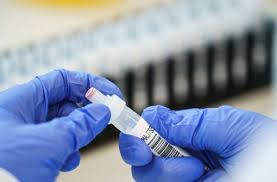 Jun 18, 2021 · el ministerio de sanidad ha registrado este viernes 4.214 nuevos casos de coronavirus, de los que 1.895 han sido diagnosticados en las últimas 24 horas, lo que eleva a 3.757.442. Lambda Variante Des Coronavirus Warum Japanische Forscher Alarm Schlagen Wissen Stuttgarter Nachrichten