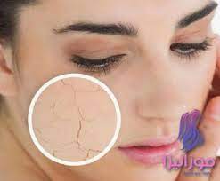 ماسك للوجه الجاف للعمل على ترطيبه وتنعيمه beauty blush