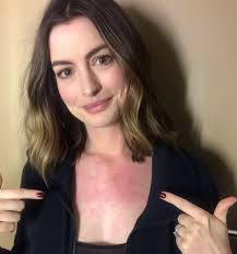 Anne Hathaway quer ser chamada de qualquer coisa, menos Anne