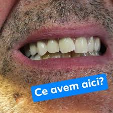 Câţi dinţi avem în gură? Cabinet Dr Cosmin Voinescu PÄƒtarlagele Posts Facebook