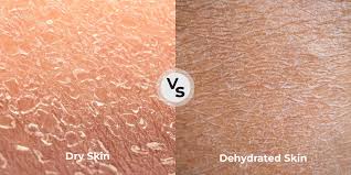Image result for Dry Skin