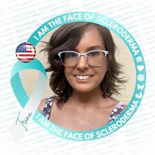 How does light therapy work for scleroderma and what kind is most effective?