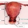 Treatment for cervical cancer depends on several factors, such as the stage of the cancer, other health problems you may have and your preferences. 1