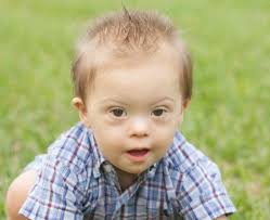 Nasi eksperci przygotują więcej aktualności o zmarszczka nakątna niebawem. Dziecko Z Zespolem Downa Wylecz To