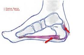 It can be painful and make it difficult to exercise or even walk. After Achilles Tendon Surgery Things To Knowzipheal