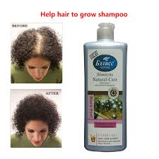 Alopecia is the general medical term for hair loss. Anti Hair Loss Chinese Herbal Shampoo Best Effect For Hair Growth Man Or Woman Professional Care 500g Free Shipping Anti Dandruff Shampoo Dandruff Shampooanti Dandruff Aliexpress