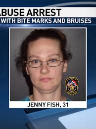 Boy with bite marks, 4 siblings removed from Kirksville home