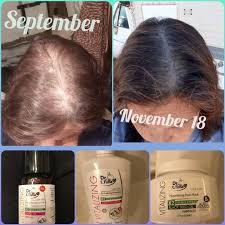 Trick To Revitalizing Your Hair Growth Beauty Tips For Glowing Skin Skin Care Hair Care Clear Skin Care