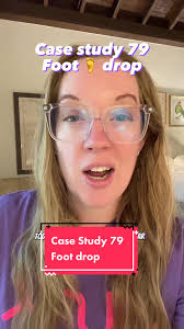 Left Leg Burning Pain in Hamstring