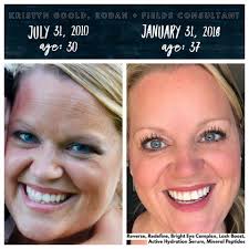 Recent before-and-after pics of Lindsay Lohan have fans speculating what  work she's had done. Here's what she's shared about her face and skin care.