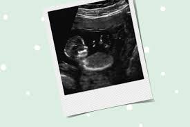 15 Ssw Schwangerschaftswoche Babygrosse Gewichtszunahme Netdoktor At