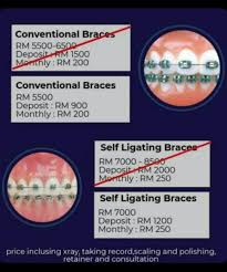 Kerajaan harga braces braces kerajaan real braces murah braces rubber bands crooked teeth dental (#australian brand) our whitening team at klinik pergigian dentist3 has tested out several (#australian brand) pasukan pemutih kami di klinik pergigian dentist3 telah menguji beberapa. Hasrat Kak Yang Pasang Braces Tercapai Di Dentalove Wangsa Maju Iamfuzy Com