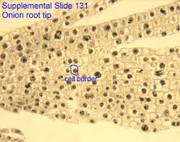 We did not find results for: Cytology