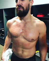 O ator e apreciador de wwe, stephen amell, teve desentendimentos com o lutador stardust, e, depois de. Arrow Star Stephen Amell Shows Off Battle Wounds After Wrestling Match