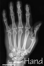 Hand Xray Human Body Science Human Body X Ray