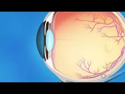 Image result for Intraocular Pressure