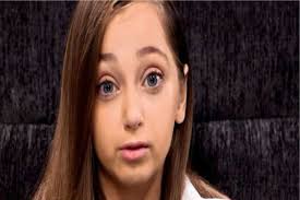 22-year-old Woman Trapped in Body of an 8-year-old, Story of Shauna Ray