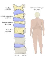 Start studying lower muscle list. Case 9 Back Pain Amboss