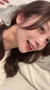 歯列矯正の始め方☆〜（ゝ。∂）