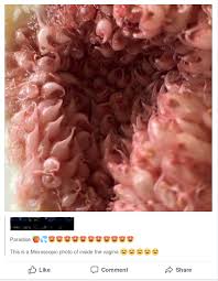 The labia minora are the inner lips of the vulva, thin stretches of tissue within the labia majora that fold and protect the vagina, urethra, and clitoris. Microscopic Photo Of The Vagina Insanepeoplefacebook