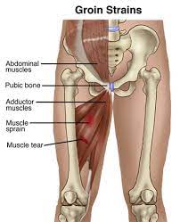 Professional sports have found groin injury the fourth most common. Groin Strain Phila Massages
