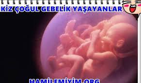 10 aylik bebek kilosu kadinlar kulubu