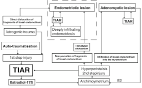 Model Of The Pathophysiology Of Endometriosis And