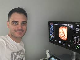 T'as cliqué au bon endroit ! Vendee Alexandre Sage Femme Imprime En 3d L Echographie D Une Future Maman Non Voyante Le Journal Des Sables